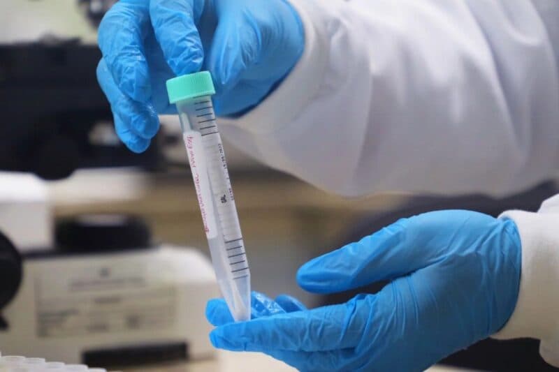 Amazonas já registrou dois casos de mpox em 2024, segundo FVS