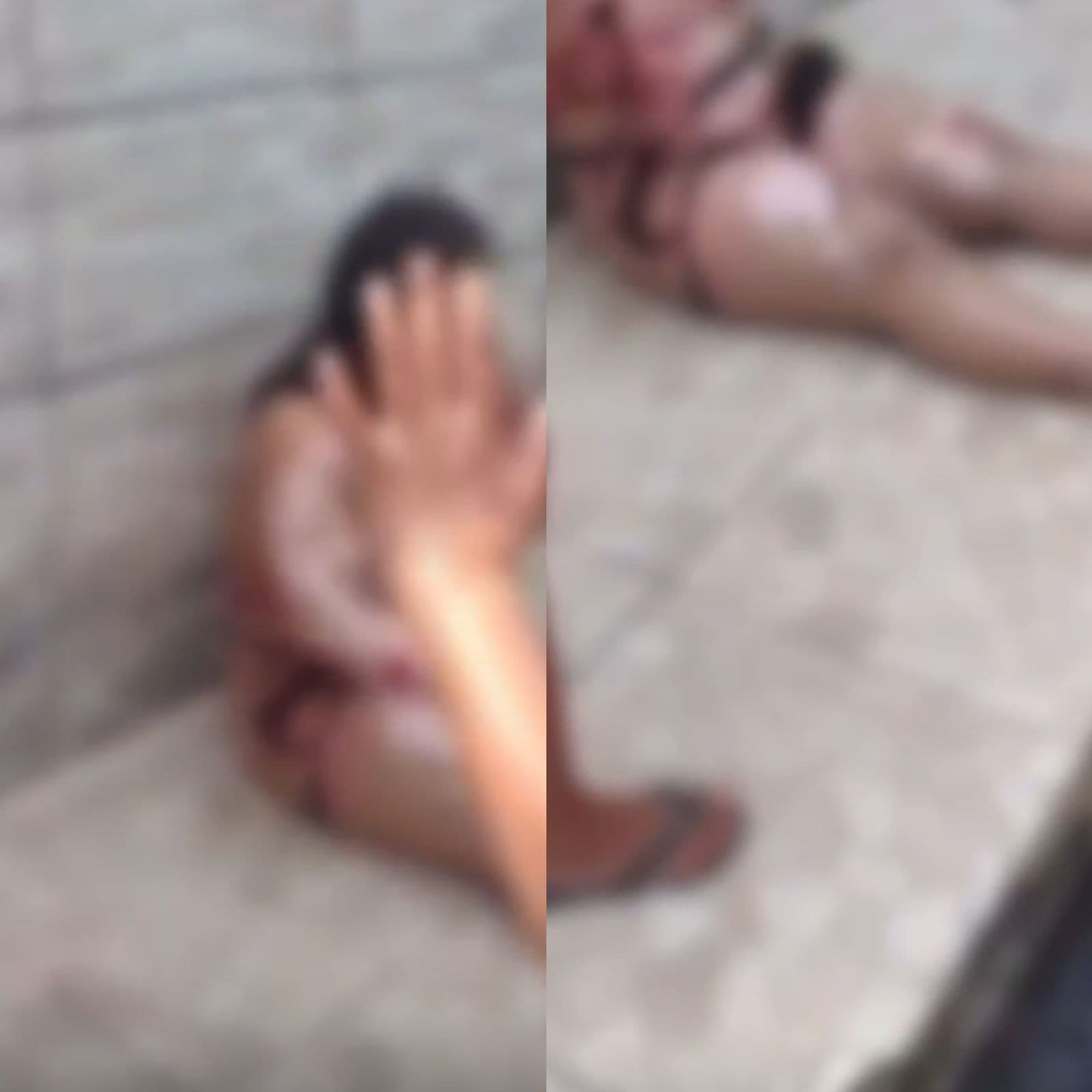 VÍDEO: Panela de pressão explode e mulher fica gravemente ferida em Maceió