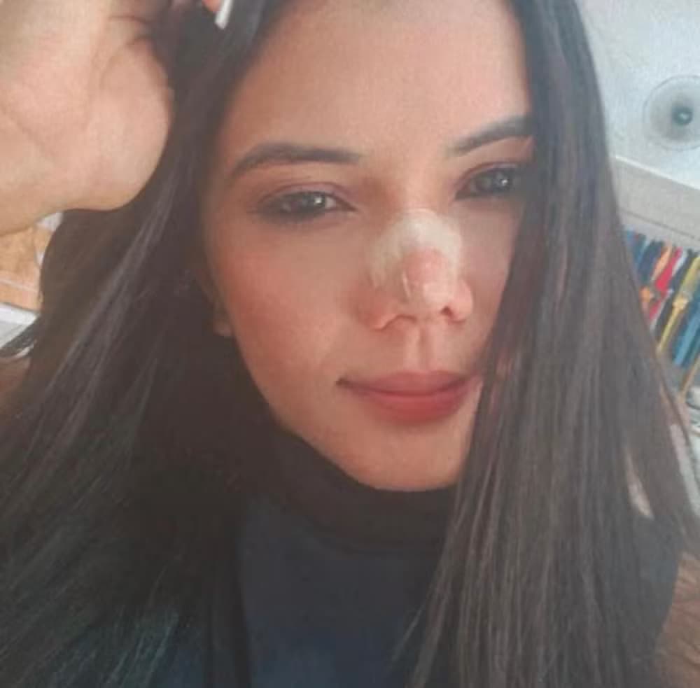 Mulher é morta a golpes de faca no Maranhão; ex-companheiro é principal suspeito