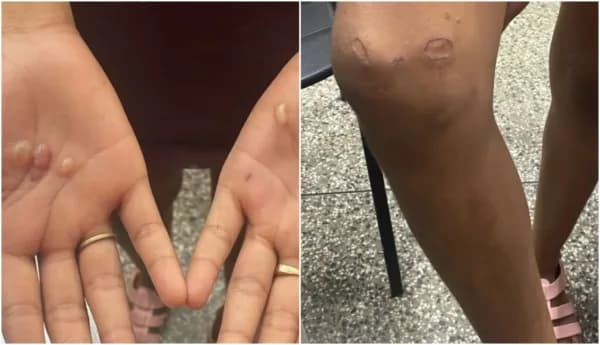 Mulher é presa por torturar adolescente de 12 anos com queimaduras e socos em Manaus