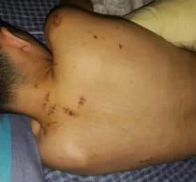 No Ceará, adolescente é esfaqueado enquanto dormia e forçado a fazer Pix para criminoso