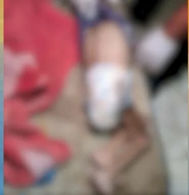 Mãe é presa após criança com paralisia cerebral morrer em Minas Gerais