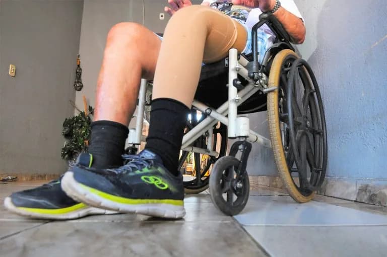 Comissão da Câmara dos Deputados aprova projeto que isenta próteses do imposto de importação para pessoas com deficiência