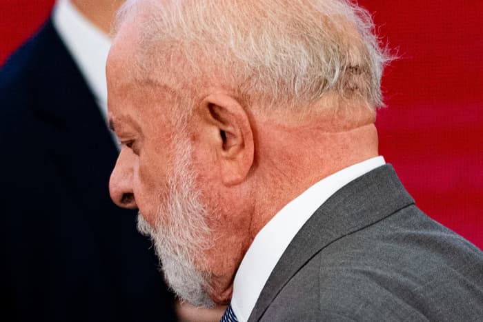 Cirurgia de emergência que perfurou crânio de Lula durou 2 horas; entenda o que é a Craniotomia