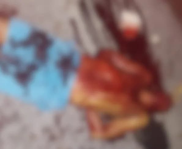 IMAGEM FORTE: Homem tem cabeça estourada de bala no Valparaíso