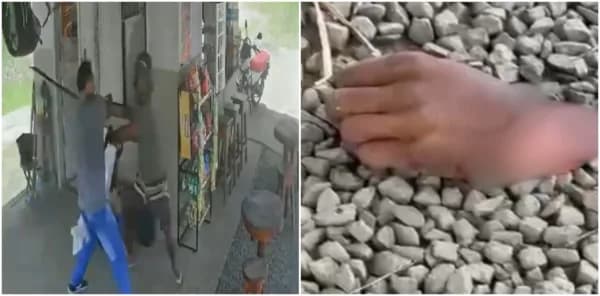 IMAGENS FORTES: Justiceiro com terçado decepa mão de ladrão na Bahia