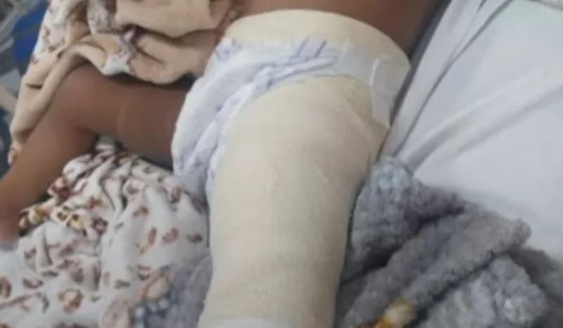 Sargento da PM é suspeito de atirar em bebê de 1 ano durante perseguição policial em Fonte Boa