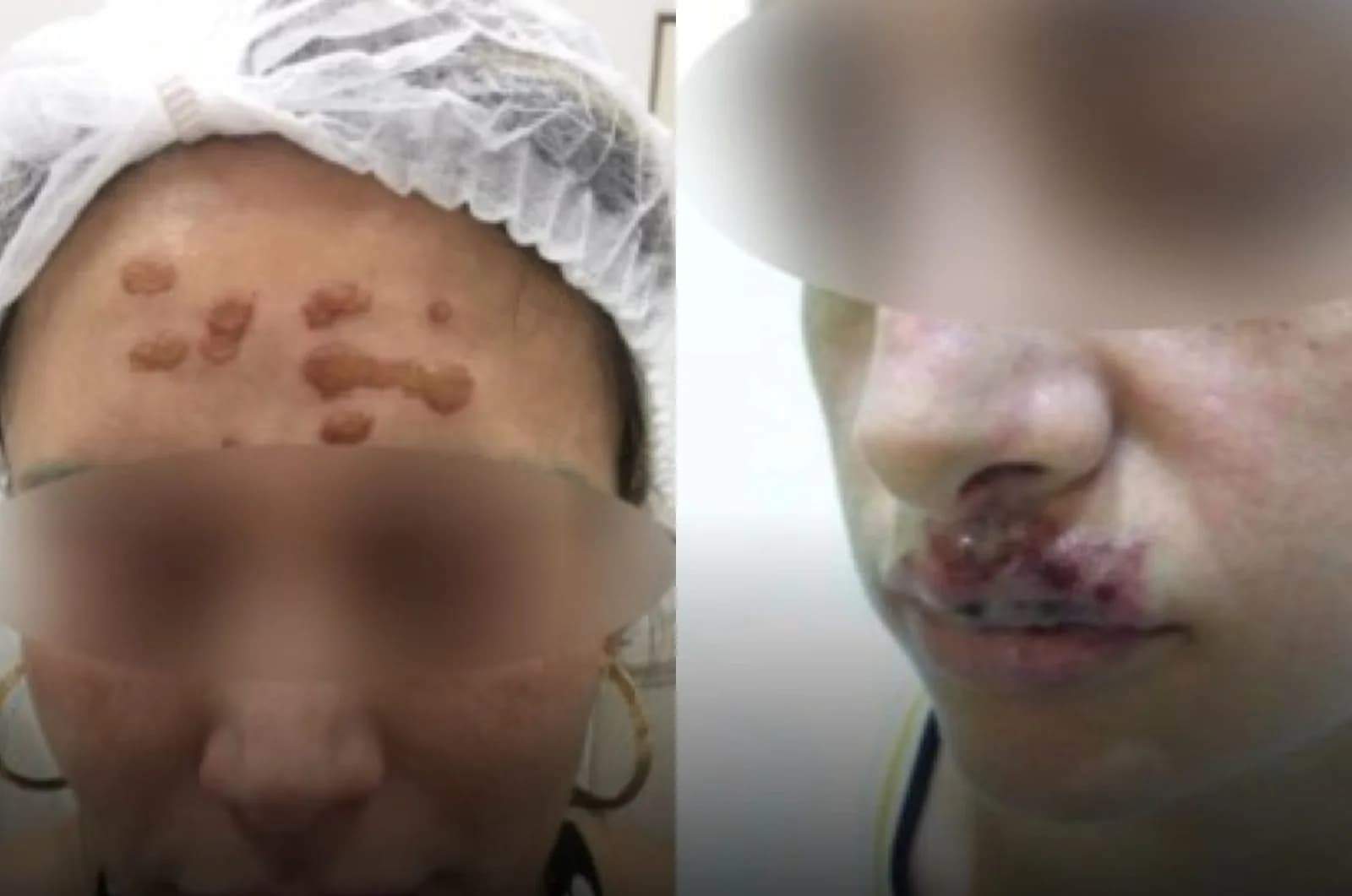 GO: Clínica médica é investigada após deixar pacientes com graves lesões