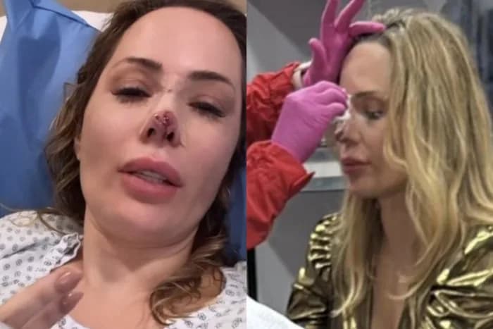 Influenciadora Ju Isen é atacada por cão no México e passa por cirurgia de emergência