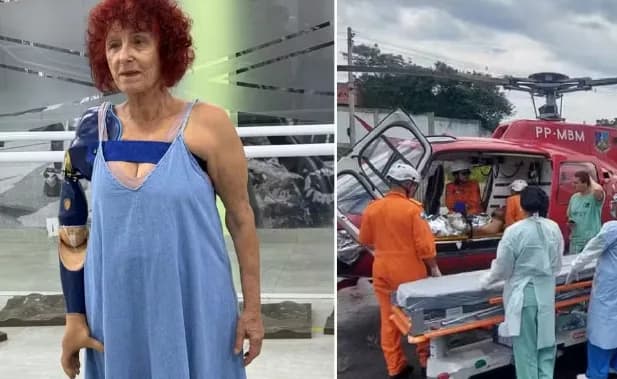 Escritora inicia adaptação a prótese biônica após ataque de pitbulls no RJ