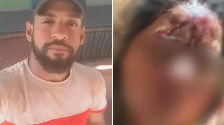 Cantor sertanejo é indiciado por agressão contra a namorada