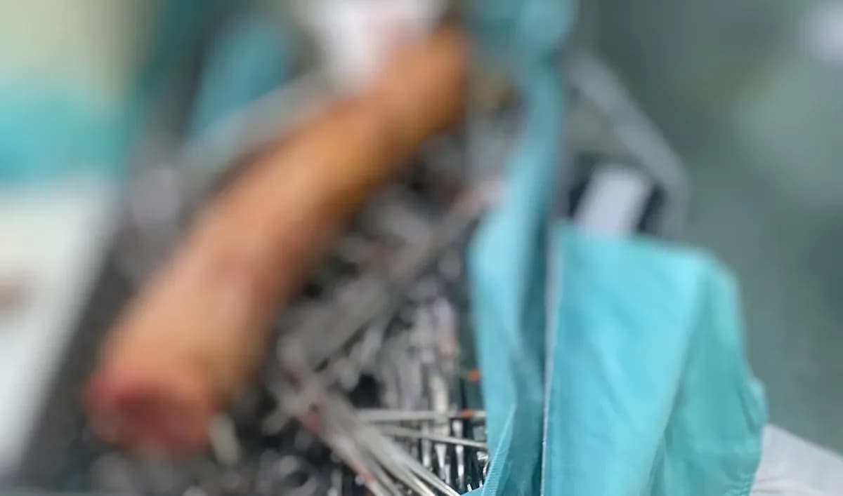 Idoso é internado com objeto de quase 1 metro no ânus