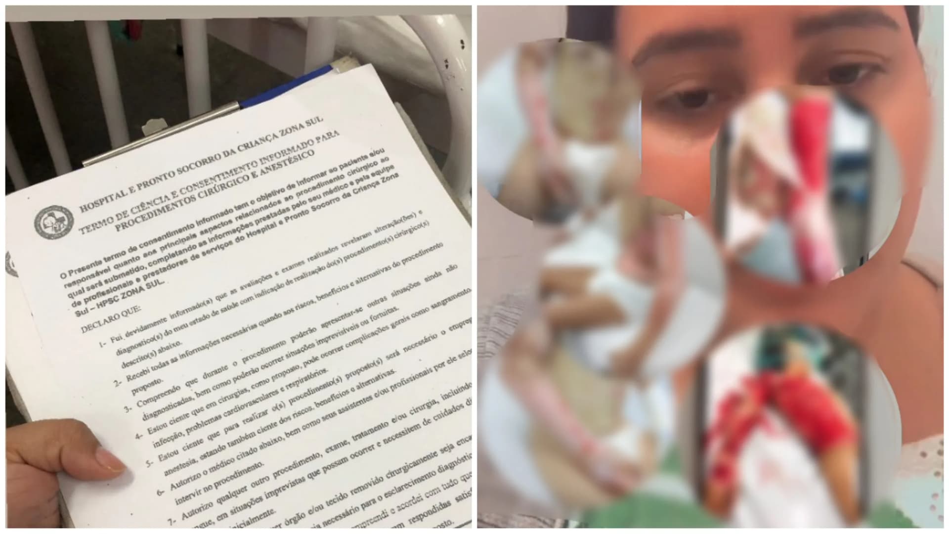 DENÚNCIA: Irmãs de 6 e 11 anos sofrem queimaduras de 3° grau após criança atear fogo; Mãe aponta omissão de responsáveis