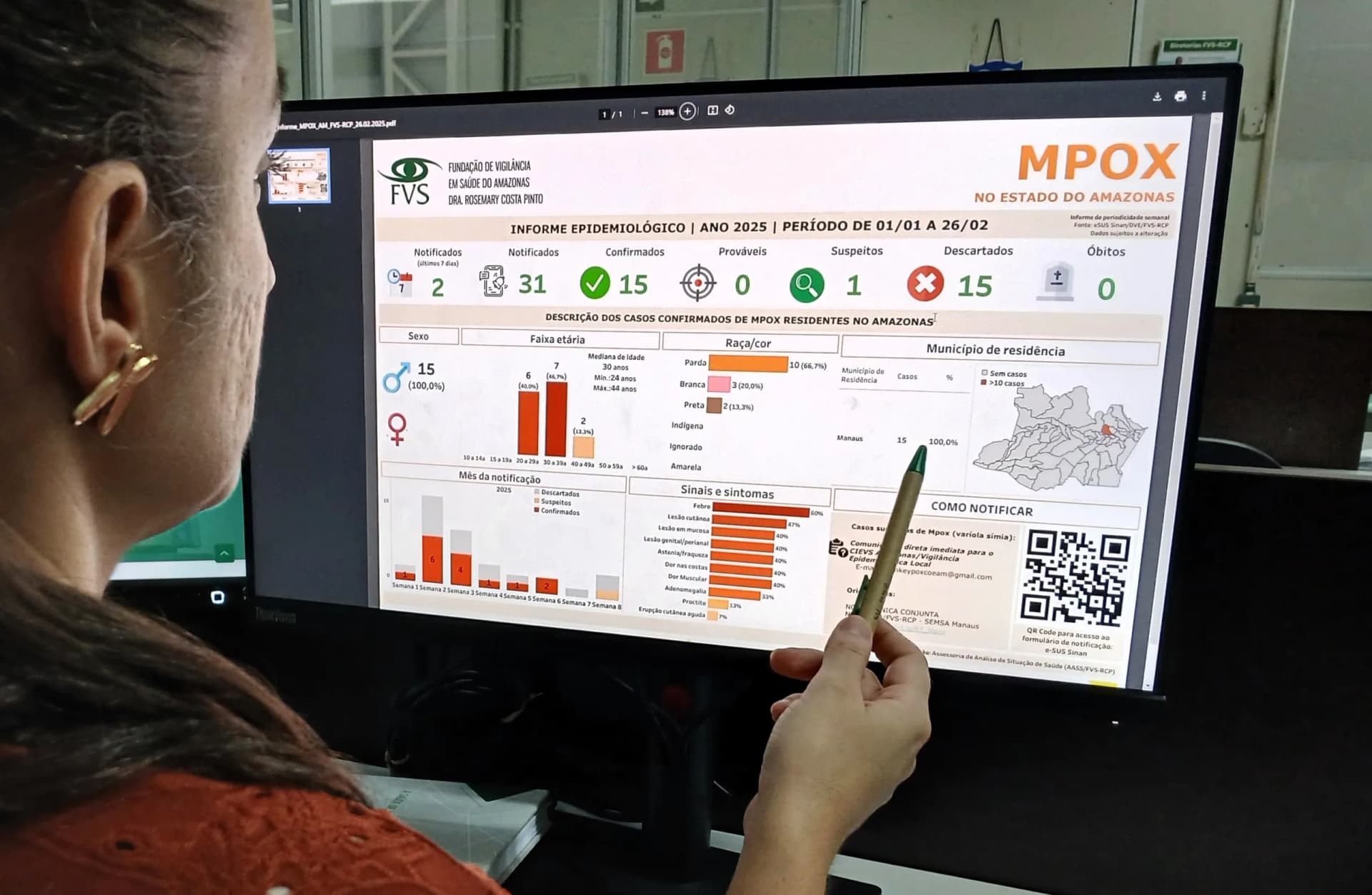 Amazonas registra 15 casos confirmados de Mpox em 2025