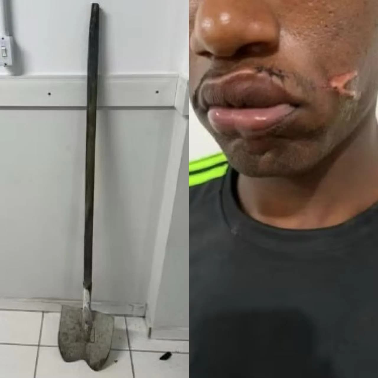 Na Bahia, mulher agride companheiro com pá por chegar tarde em casa