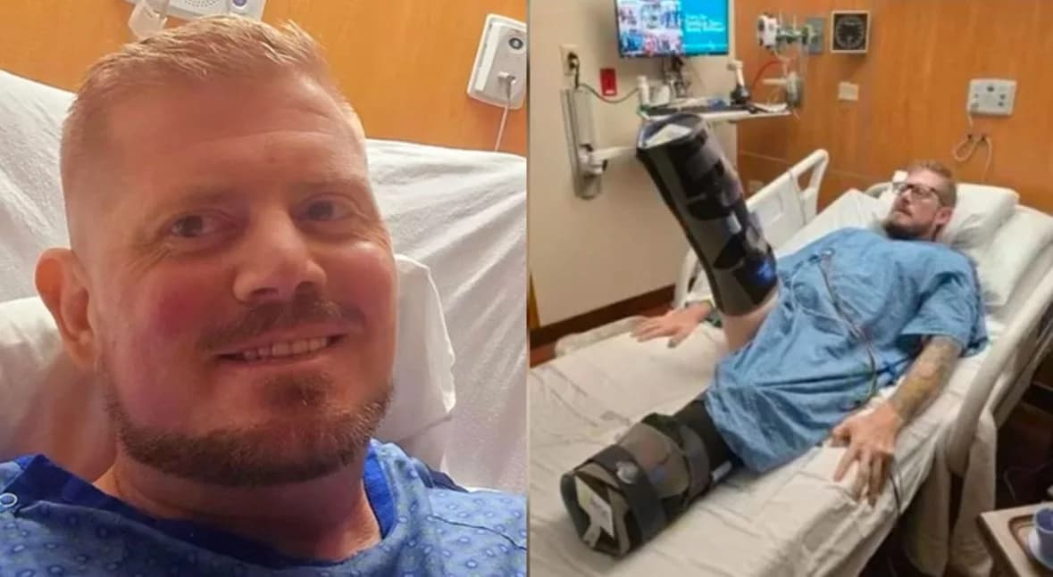 Homem tem pernas amputadas após queimadura na mão; Entenda