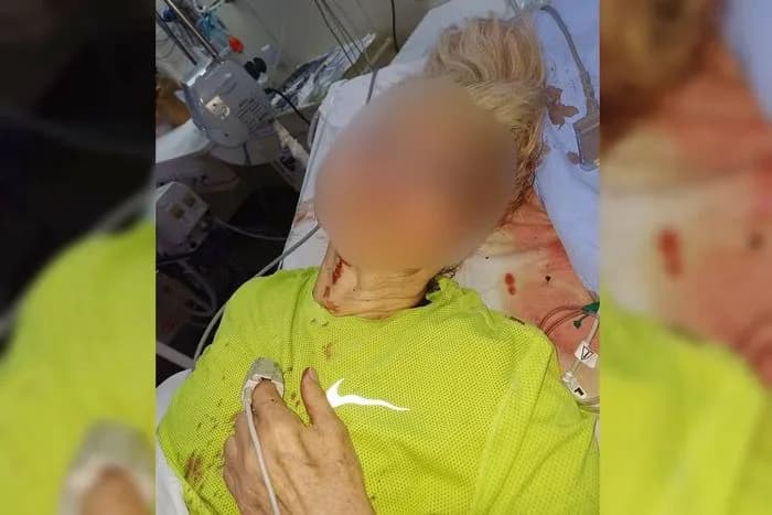 Idosa é agredida por usuário de drogas em Brasília