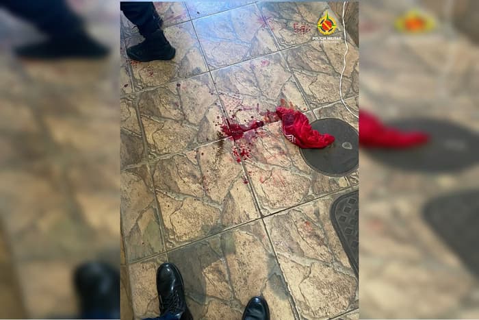 Homem esfaqueia vizinho após cueca sumir de varal no DF