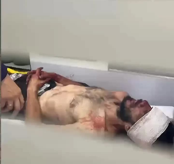 Homem despenca do 2º andar de prédio em Manaus