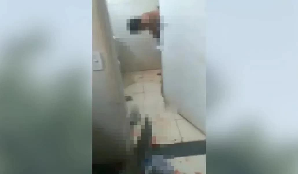 VÍDEO: Mulher queima pênis do marido ao suspeitar de traição, em SP