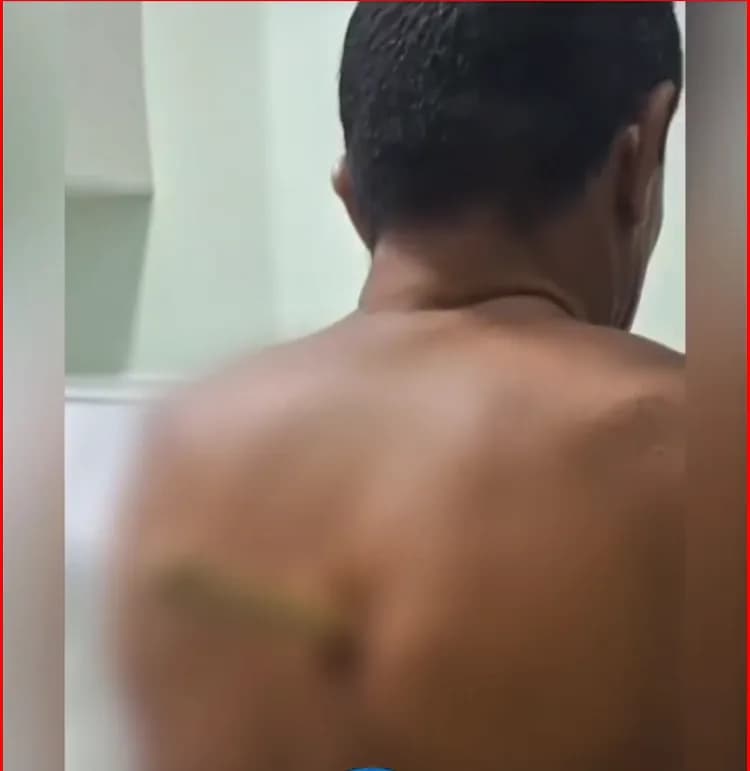 VÍDEO: Homem fica com faca cravada nas costas depois de briga