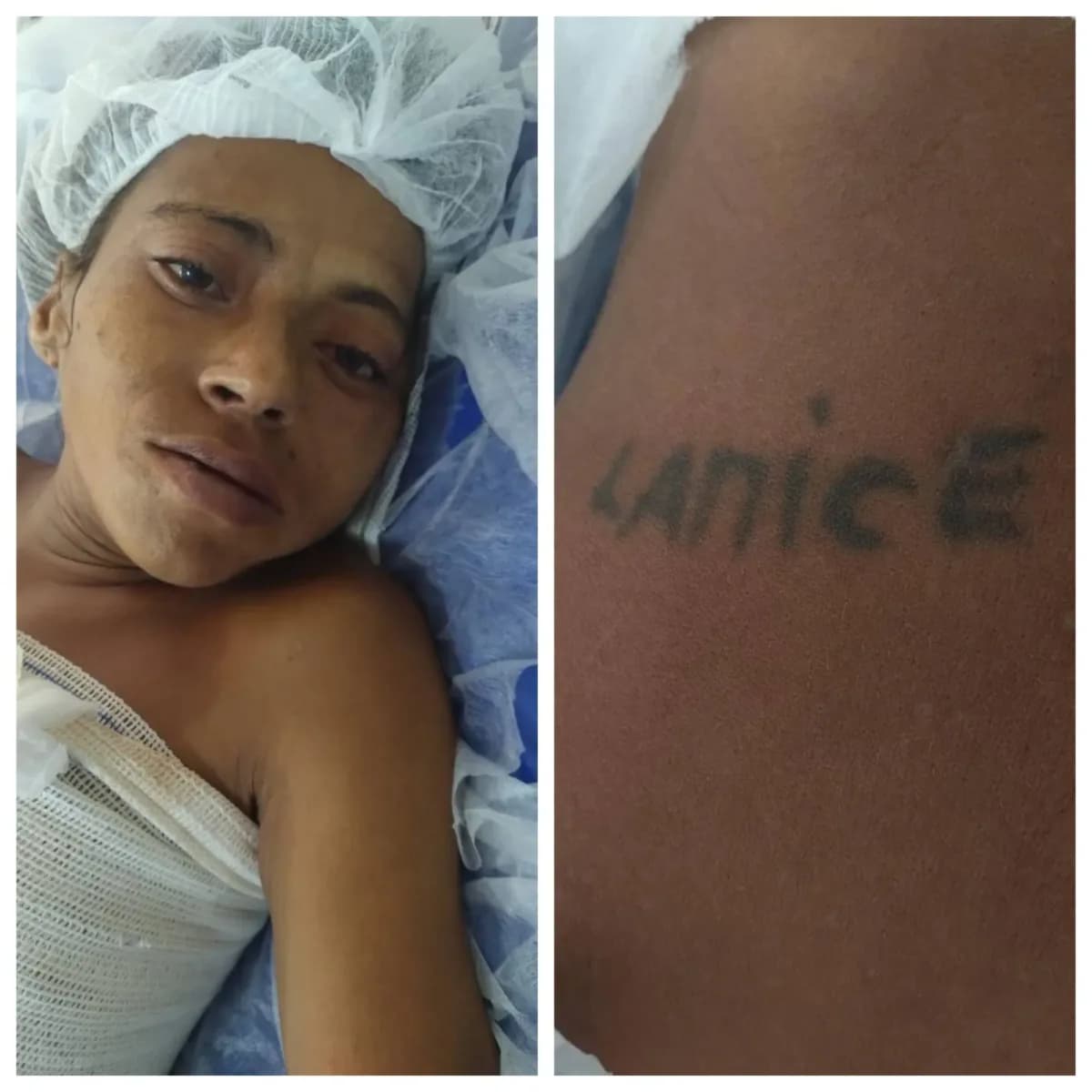 Hospital procura familiares de mulher internada após cair da escada em Manaus