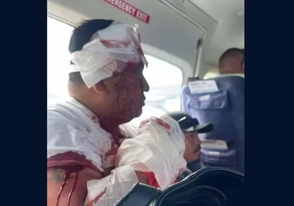 Homem tenta sequestrar avião em Belize e é morto por passageiro armado