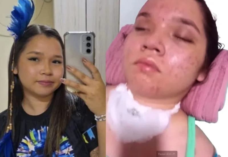 “Ela não se move, não faz nada”: mãe de Flávia Catarina mostra jovem em estado vegetativo