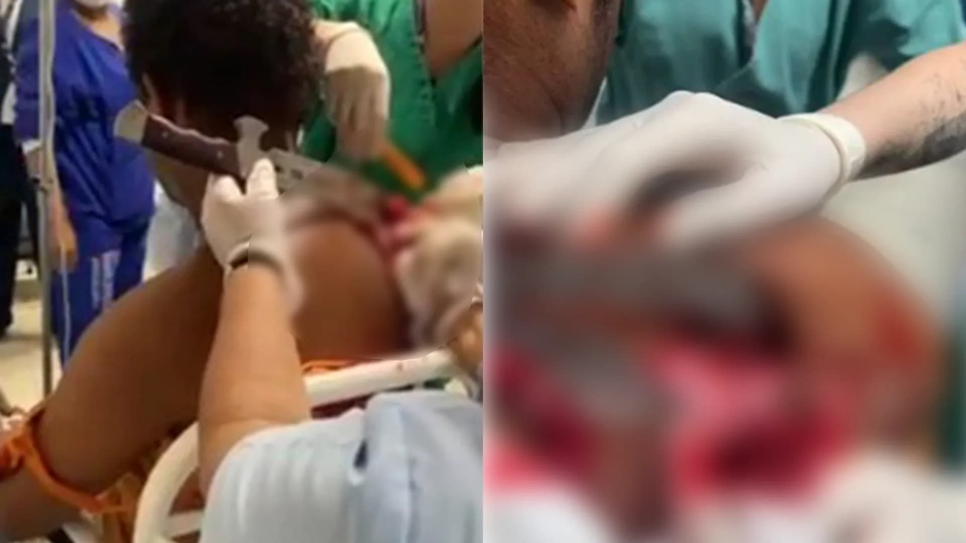 IMAGENS FORTES: Homem chega ao hospital com espada cravada no ombro