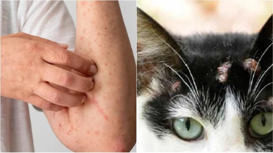 Esporotricose: Amazonas registra aumento de casos; saiba o que é e como prevenir