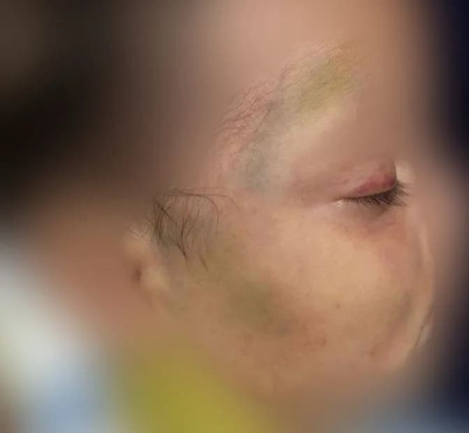 IMAGEM FORTE: Pai é preso por espancar 2 bebês em Manaus