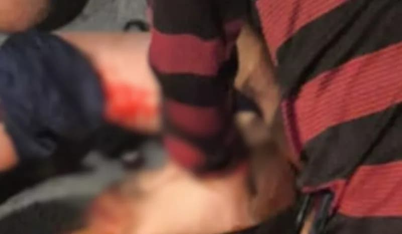 Criança de 10 anos é atropelada enquanto brincava de “papagaio” na zona Norte de Manaus