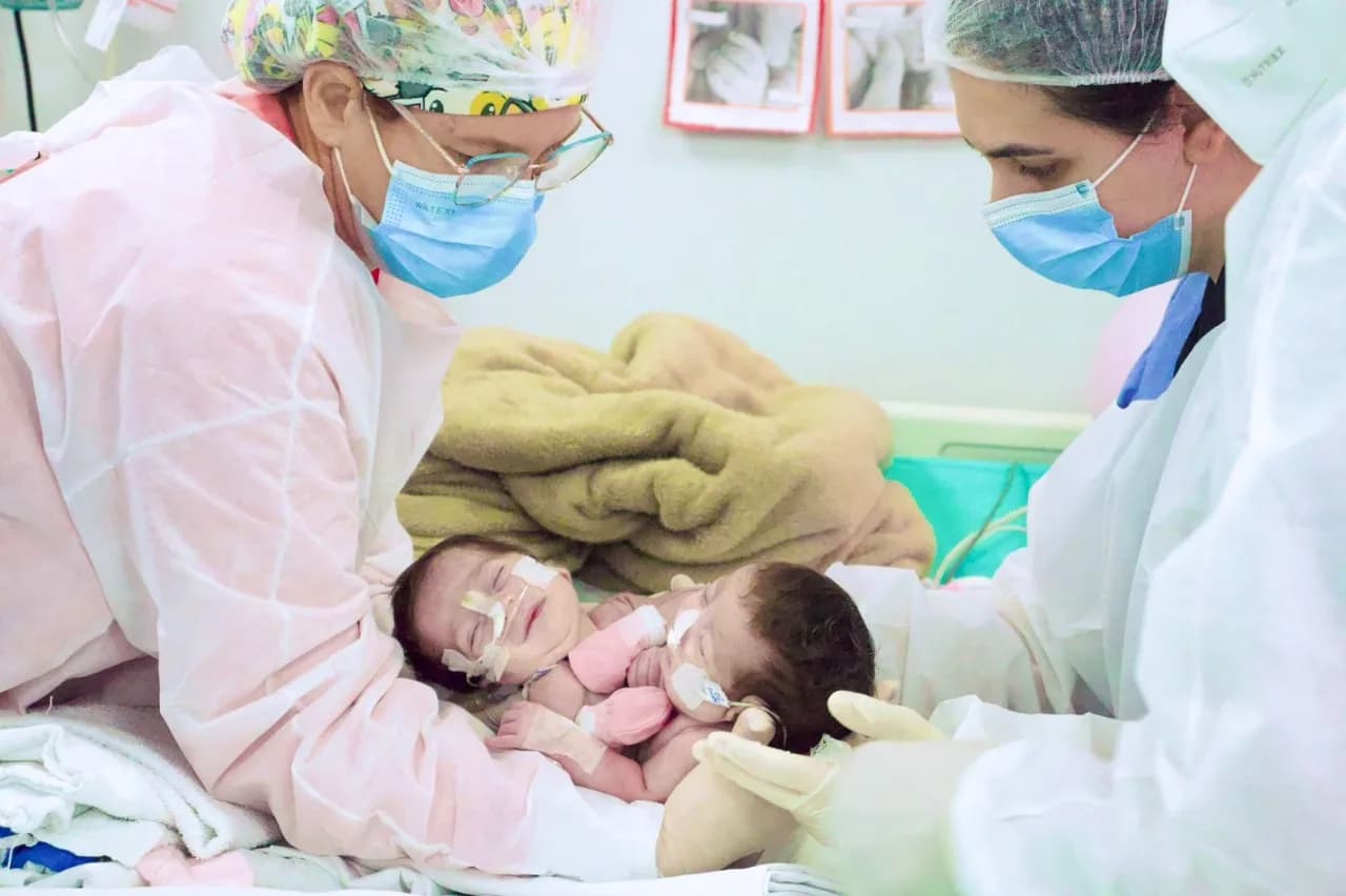 Cirurgia de separação das gêmeas siamesas nascidas no Amazonas é bem-sucedida em Goiânia