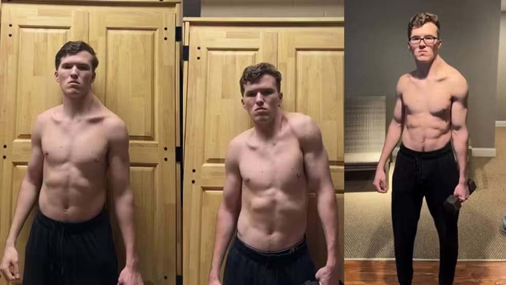 “Homem torto”: influencer treina somente um lado do trapézio e viraliza ao mostrar resultado