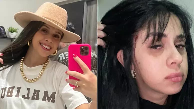 Cantora sertaneja é atacada na porta de casa e tem o cabelo cortado por criminoso