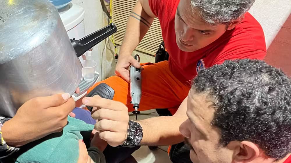 MG: Bombeiros salvam menino de 2 anos com panela de pressão presa na cabeça