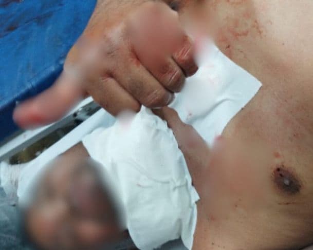 Homem é esfaqueado no pescoço pela própria esposa no São Raimundo