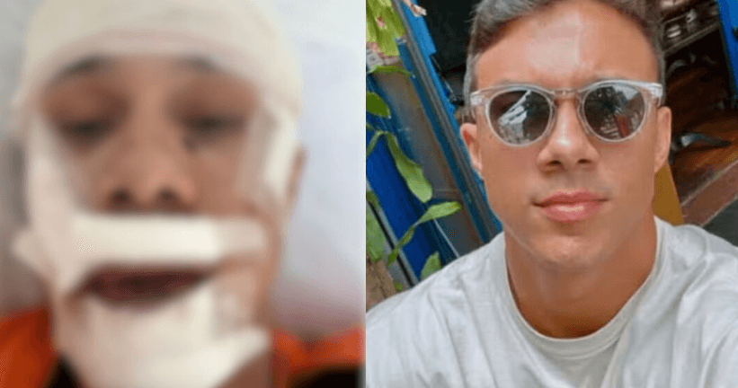 VÍDEO: Personal trainer é agredido com taça ao defender mulher em bar no interior de SP