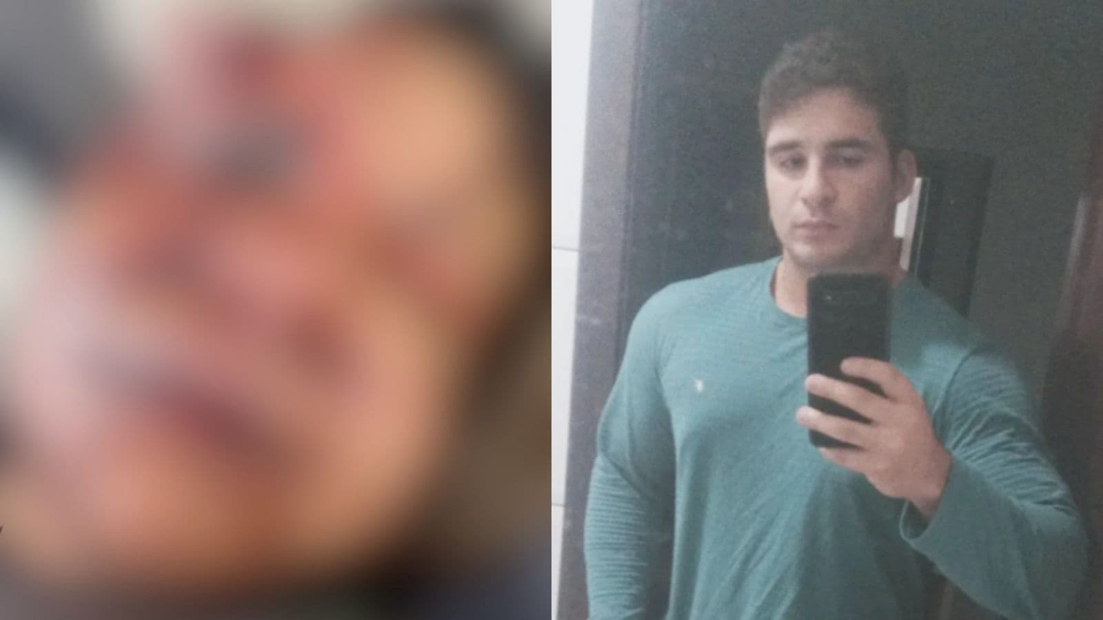 IMAGEM FORTE: veja como ficou o rosto da mulher agredida por ex-jogador de basquete com 61 socos em Natal