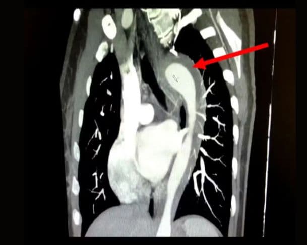 Mulher de 45 anos quase morre após relação sexual com o marido; entenda
