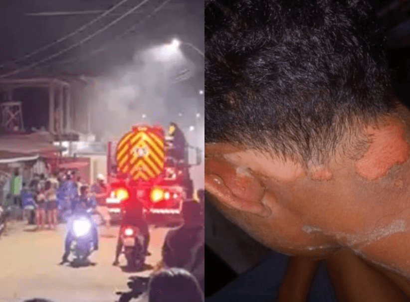 VÍDEOS: Moradores ateiam fogo na casa de adolescente suspeita de jogar água quente em criança