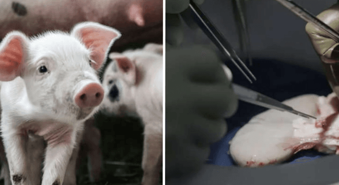 China testa pulmão de porco modificado em humano com morte cerebral
