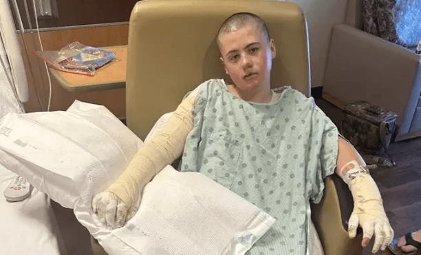 Desafio de rede social termina com menino de 12 anos gravemente queimado nos EUA