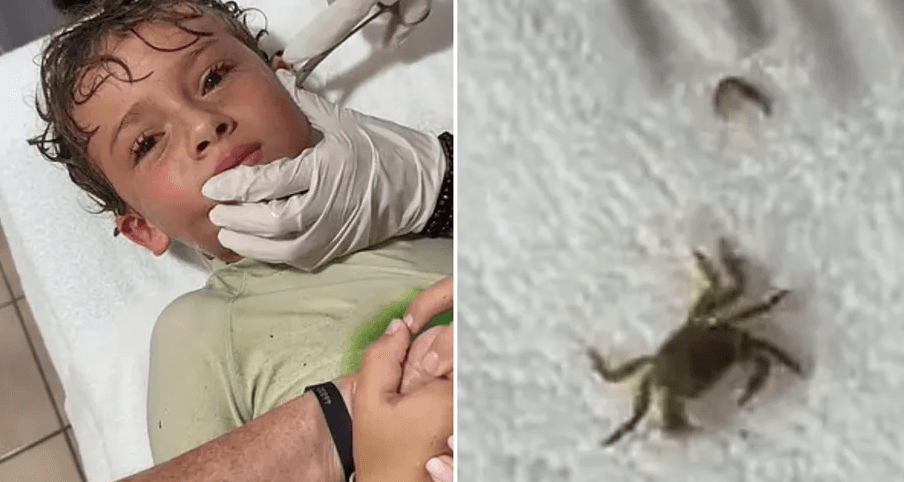 Menino tem caranguejo vivo retirado do ouvido; veja vídeo