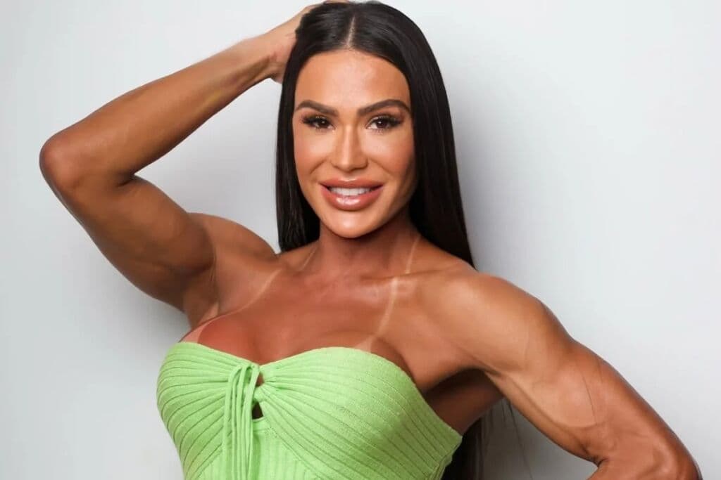 Gracyanne Barbosa passa por cirurgia após acidente no “Dança dos Famosos”