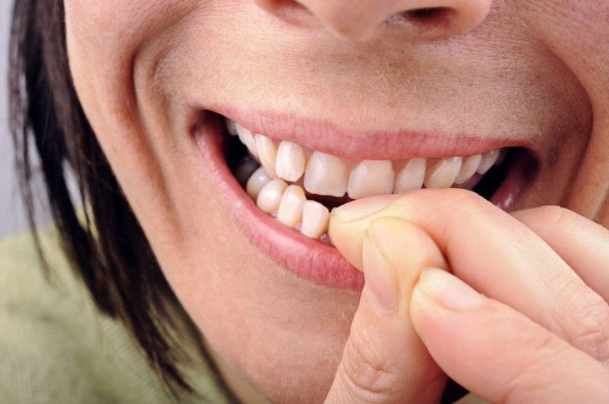 Você sabia que roer as unhas pode causar mau hálito? Especialista explica