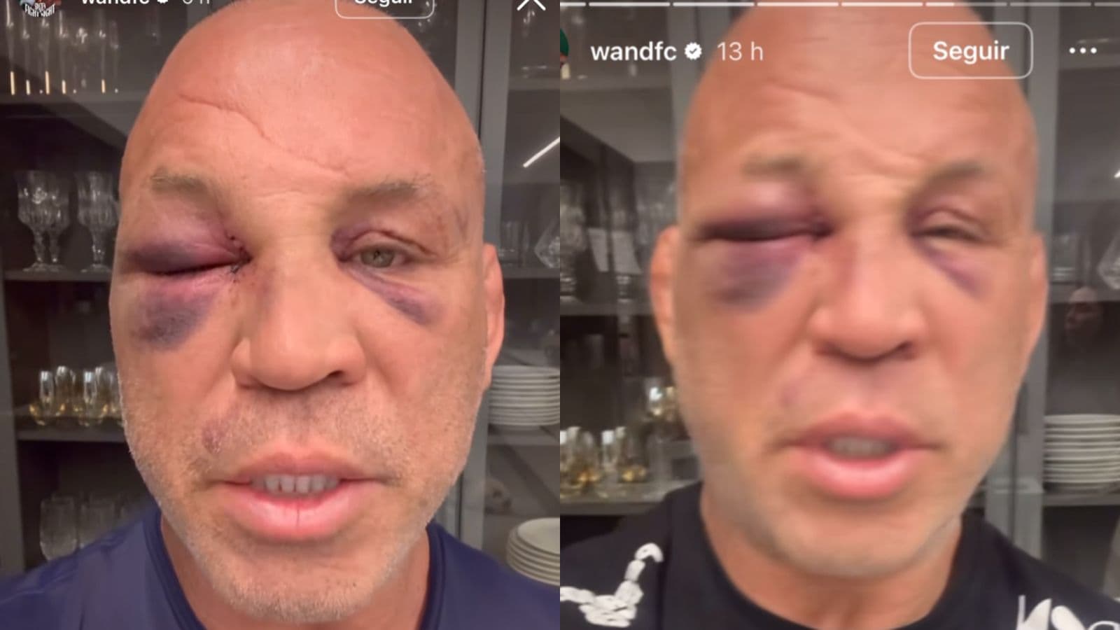 Wanderlei Silva relata perda de memória após pancadaria no Spaten Fight Night