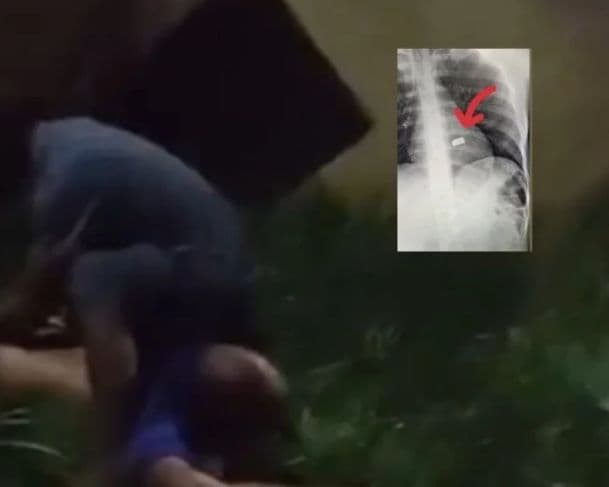 Imagens fortes: ‘Livrinho’ é baleado por criminosos e agoniza até a morte