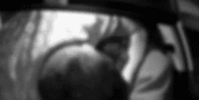 Motorista de aplicativo tem lábio arrancado durante tentativa de assalto em GO