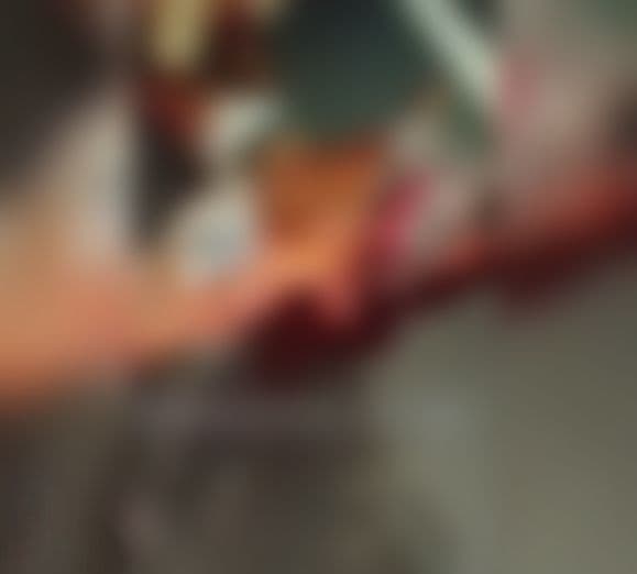 Grave acidente na MA-225 entre moto e vaca deixa duas pessoas mortas